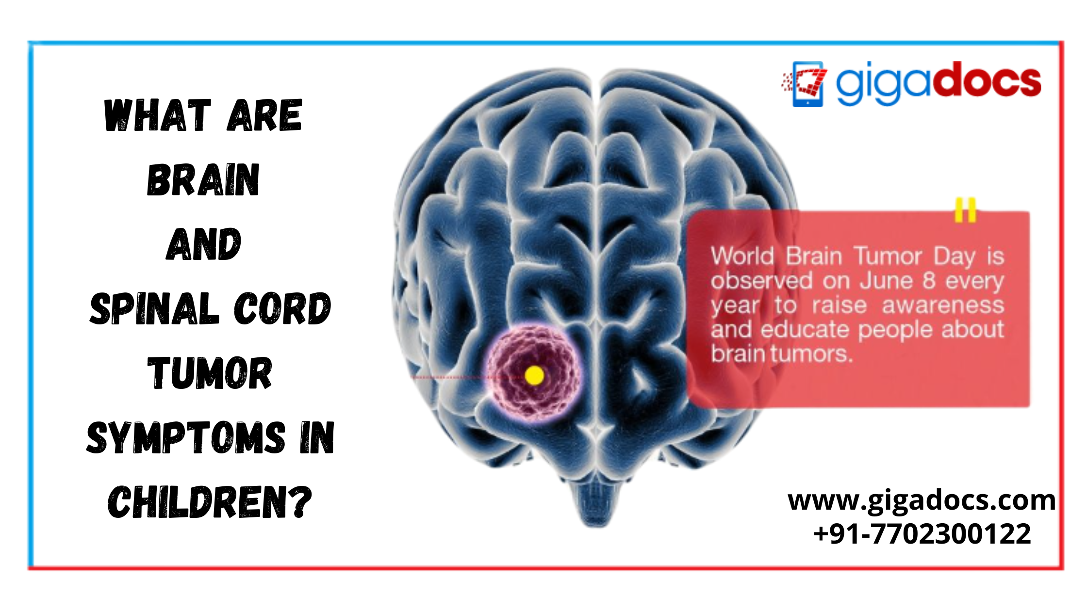 World Brain Tumor Day: What are brain and spinal cord tumor symptoms in  children? - Gigadocs - Online Appointment with Best Doctors